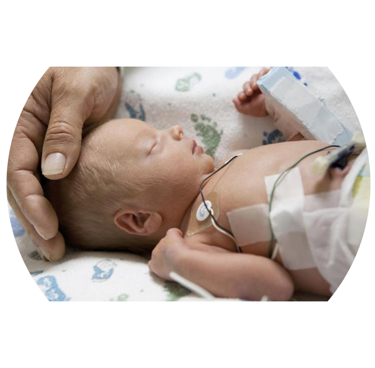 Neonatal Surgery