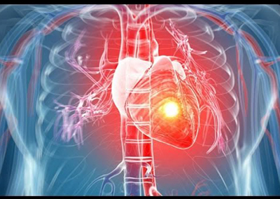 Device Closure For ASD, VSD, PDA