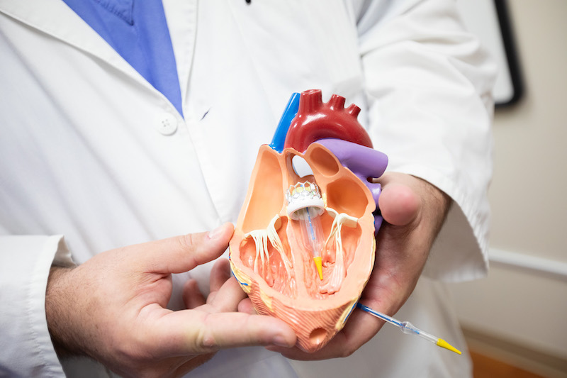 TAVI / TAVR vs Traditional Surgery Benefits